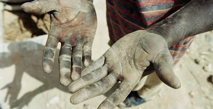 person exposing hands, pals up